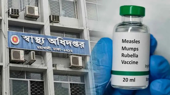হাম উপসর্গে আরও ৫ জন সহ মোট মৃত্যু ১০৮১